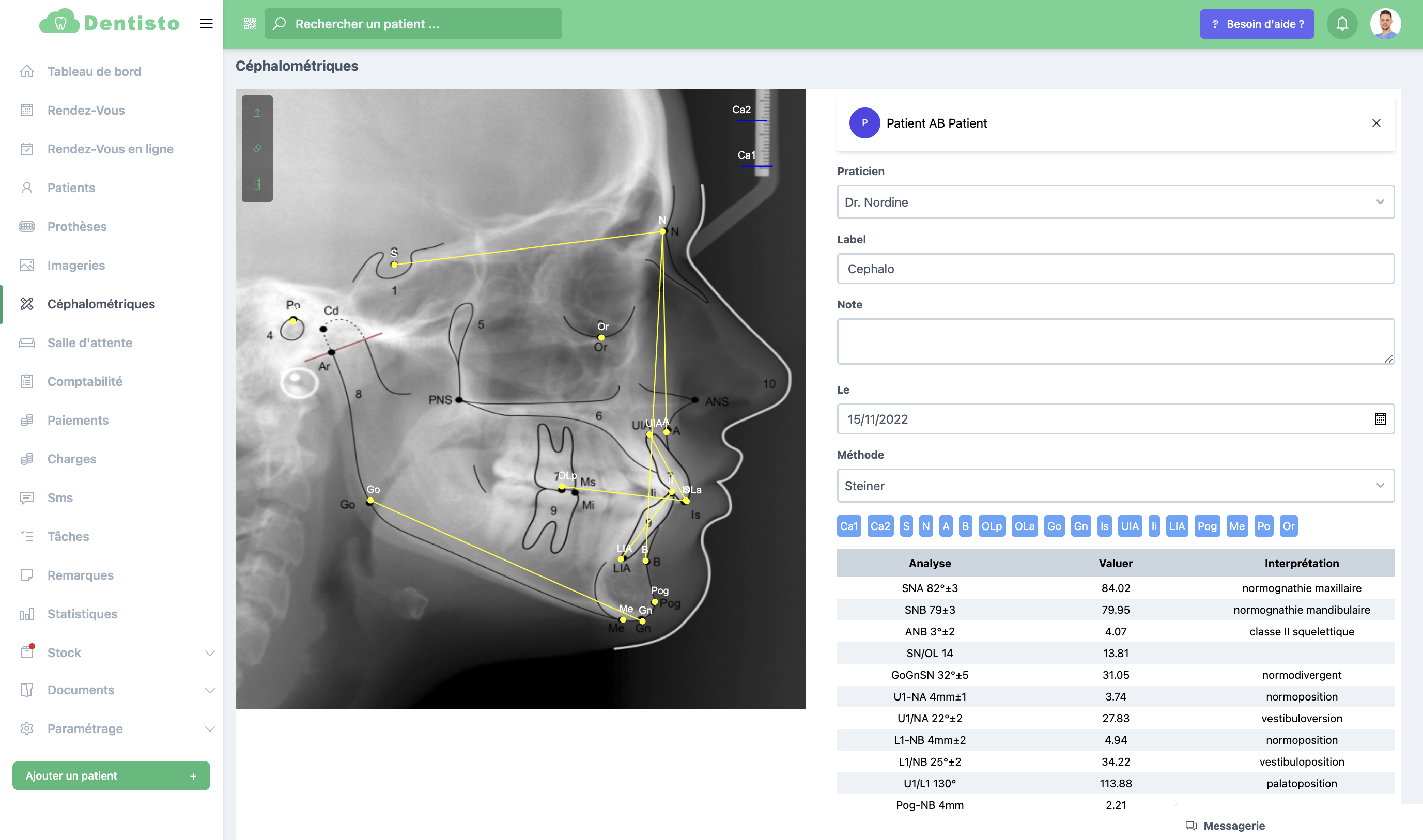 Logiciel de gestion de cabinet dentaire cephalo